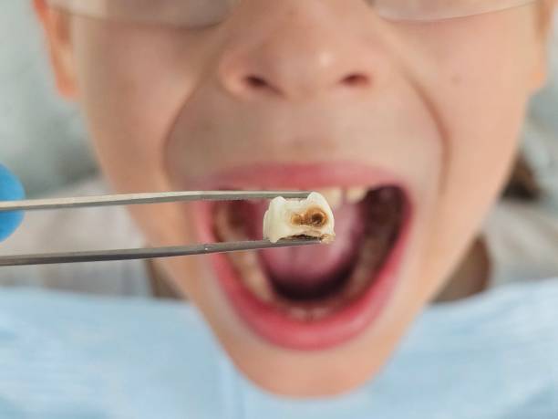 Best Dentist Open Late Near Me  in Midland, WA